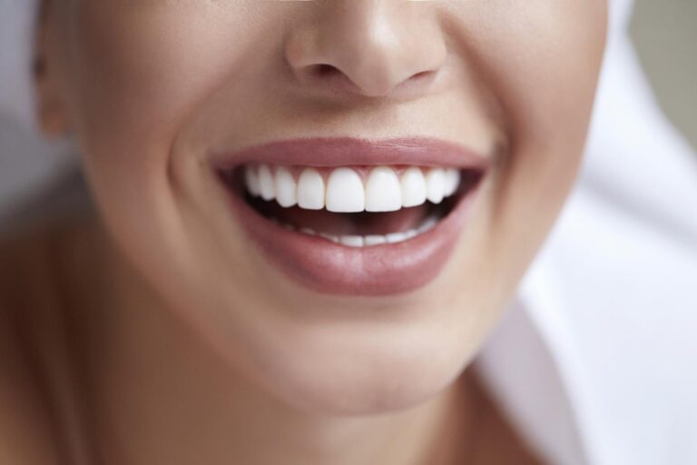 Close-up of a smiling mouth showing bright, straight teeth enhanced with dental veneers, highlighting cosmetic dental results.